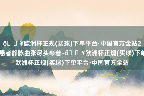 🔥欧洲杯正规(买球)下单平台·中国官方全站2. 卧床的东谈主部分患者静脉曲张尽头彰着-🔥欧洲杯正规(买球)下单平台·中国官方全站